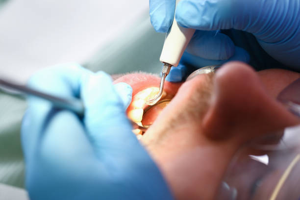 Best Same-Day Emergency Dentist in Fairfax, CA